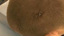 12 staples